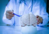 A doctor pointing at a brain model with a pen