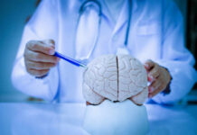 20-Year Study Shatters Dementia Assumptions A doctor pointing at a brain model with a pen