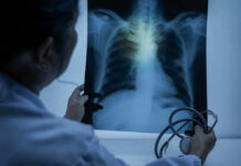 Doctor examining a chest X-ray with a stethoscope in hand