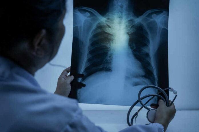 shutterstock_2482877961.jpg Doctor examining a chest X-ray with a stethoscope in hand