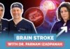 Stroke Explained by a Neurologist: Signs, Risks, and What