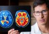 Ozempic Mental Health Effects, Explained for Beginners