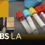 Surprising New Cancer Screening Guidelines Doctor discusses new colon cancer screening guidelines