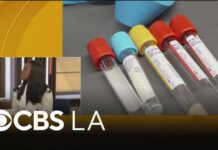 Doctor discusses new colon cancer screening guidelines