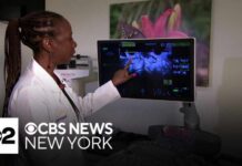 170 Million Affected: Syndrome Gets New Name Hormonal condition PCOS gets new name in effort to improve care