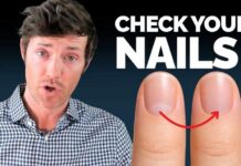 The Thyroid Nail Test That Doctors Miss