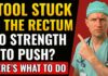 Stool STUCK in the Rectum! Causes, Symptoms, and Treatments Stool STUCK in the Rectum! What is it and what to do? | Doctor Explains