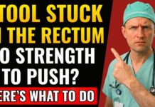 Stool STUCK in the Rectum! Causes, Symptoms, and Treatments Stool STUCK in the Rectum! What is it and what to do? | Doctor Explains