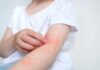 The Rash That Hijacks Nights Child's arm showing skin irritation and redness