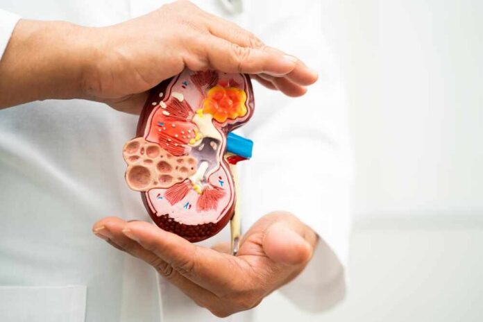 Kidney,Disease,,Chronic,Kidney,Disease,Ckd,,Doctor,Hold,Model,To A healthcare professional holding a detailed model of a kidney
