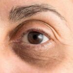 Close-up of a human eye with visible wrinkles and eyebrow