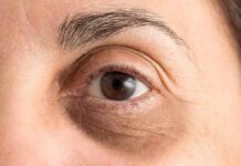 Close-up of a human eye with visible wrinkles and eyebrow