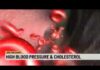 Cardiologist’s tips to manage blood pressure and cholesterol