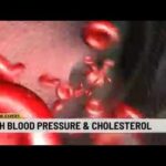 Cardiologist’s tips to manage blood pressure and cholesterol