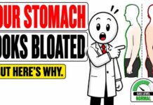 Why Your Stomach Looks Bloated When It's Not Full of Gas