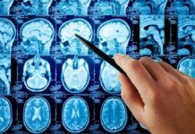 Hand pointing at brain MRI scans with a pen