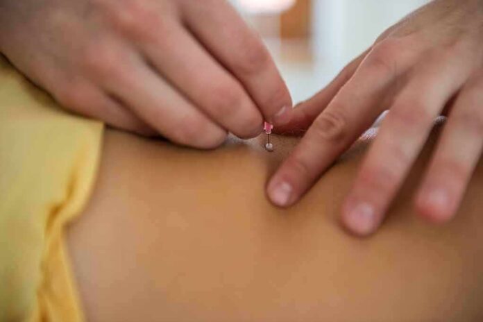 shutterstock_1341856898-1 Hands inserting an acupuncture needle into a person's back