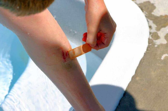 Child applying a bandage to a scraped knee near a pool